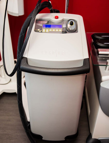Laser Alexandrite pour l'&eacute;pilation